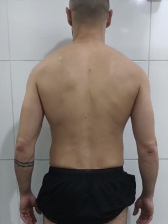 Costa antiga